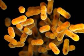 La Klebsiella oxytoca es una bacteria gramnegativa que forma parte de la microbiota normal del tracto gastrointestinal, pero que, en ciertas condiciones, puede causar infecciones graves.