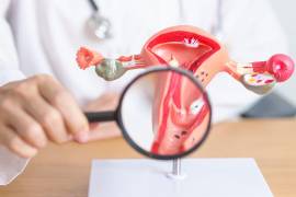 The Lancet impulsa cambiar SOP por PMOS para mejorar diagnósticos, reducir estigmas y visibilizar efectos hormonales y metabólicos.