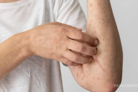 Todos los pacientes confirmados se encuentran asintomáticos y bajo vigilancia médica.