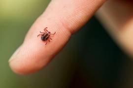 Advertencia. La rickettsia es causada por la picadura de una garrapata; la atención inmediata es clave para evitar el deceso.Wood Tick on finger