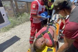 La conductora perdió el control de la motocicleta al intentar evitar a un perro que se atravesó en su camino, sufriendo lesiones en las piernas y una probable fractura de cadera.