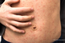 Autoridades de Salud activaron cerco sanitario en el rancho Azteca de Nava.