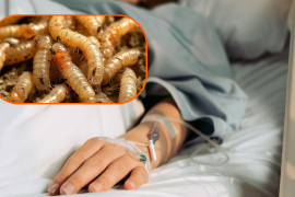 Contagios de gusano barrenador en humanos se extienden a Yucatán y Tabasco