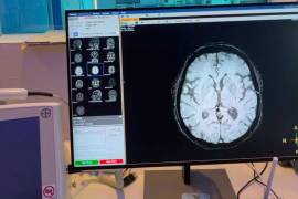 El Código Cerebro busca reducir los tiempos de respuesta ante eventos como embolias cerebrales y disminuir el riesgo de discapacidad.
