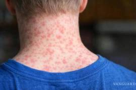 El repunte de casos mantiene en observación a menores no vacunados y población vulnerable.