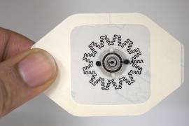 El apósito hidráulico sin electrónica (WPED) que estimula eléctricamente los tejidos promueve la cicatrización de las heridas crónicas.