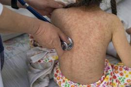 Señalan que una vez que el virus entra al organismo, puede mantenerse en estado latente entre 10 y 12 días.