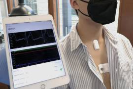 ‘App’ en una ‘tablet’ muestra el electrocardiograma trasmitido desde el dispositivo en el pecho.
