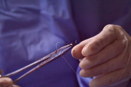 Menor de edad fallece tras cirugía estética en Durango; caso causa debate en redes sociales