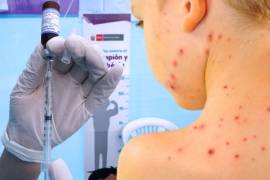 Personal médico prepara dosis de la vacuna triple viral en un Centro de Salud.