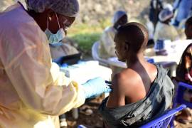 Epidemia de sarampión causa más muertes que el ébola
