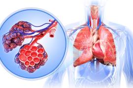 Los síntomas de la hipertensión arterial pulmonar, como fatiga y dificultad para respirar, son fácilmente confundidos con otras condiciones.