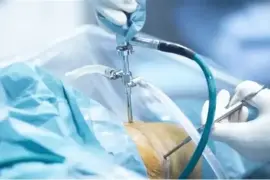 El Hospital General Salvador Chavarría se prepara para una nueva campaña de colocación de prótesis de rodilla dirigida a pacientes con severas limitaciones de movilidad.