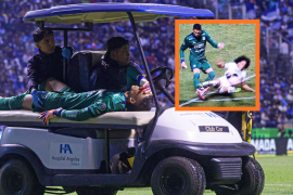 El arquero colombiano Kevin Mier será operado el 13 de noviembre de 2025 tras sufrir una fractura de tibia derecha en el partido entre Cruz Azul y Pumas UNAM.