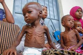 Más de 350 mil niños podrían morir a causa de la desnutrición antes de septiembre si la situación no mejora