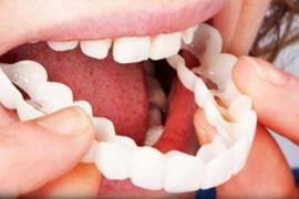 Las prótesis dentales de silicona que se comercializan de manera masiva y a bajo costo, lejos de mejorar la salud bucal pueden generar complicaciones.