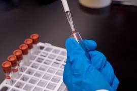 Universidad de Oxford podría tener vacuna contra COVID-19 en septiembre