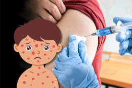 La Secretaría de Salud confirmó 4,353 casos de sarampión y 17 muertes en México; ante el aumento de contagios, se refuerza la campaña nacional de vacunación gratuita para toda la población.