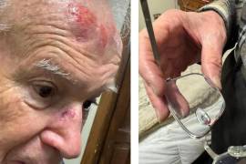 El obispo Raúl Vera muestra en redes sociales las lesiones que sufrió tras tropezar en una banqueta del Centro Histórico.