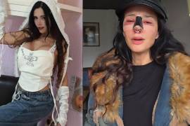 La reconocida modelo argentina y conductora de Televisa, Dora Noemí Kerchen, mejor conocida como Dorismar, denunció haber sido víctima de una “mala praxis” tras una cirugía estética.