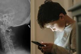 Si el crecimiento comprime un nervio o dificulta la circulación sanguínea, puede provocar inflamación, dolor y otros problemas