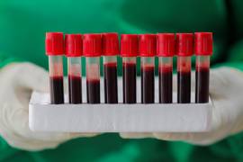 La hemofilia se caracteriza por un sangrado excesivo, que puede ser externo o interno. EFE/EPA/Chamila Karunarathne
