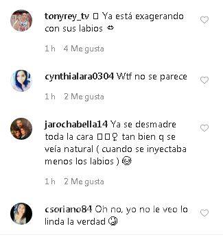 $!Eiza González se hace nuevo retoque al rostro y a la gente no le agrada