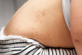 Se indicó que en Jalisco participan autoridades sanitarias federales, estatales y municipales.