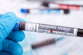 Confirman primera muerte por virus de Marburgo; ‘debemos detenerlo en seco’, alerta la OMS
