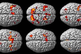 Una revisión invalida miles de estudios del cerebro