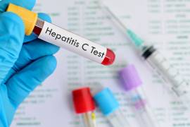 Con antivirales podrá curarse en semanas a enfermos de hepatitis C