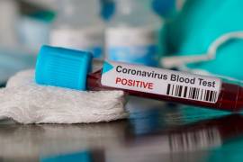 Tienes más riesgo de contraer coronavirus si tu sangre es tipo A
