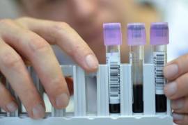 Suspenden laboratorio antidoping de México