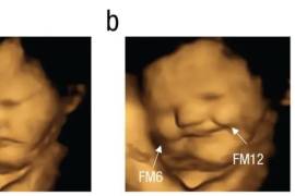 Para probar la capacidad de degustar sabores en el útero, los investigadores tomaron imágenes de ultrasonido de aproximadamente 70 bebés por nacer