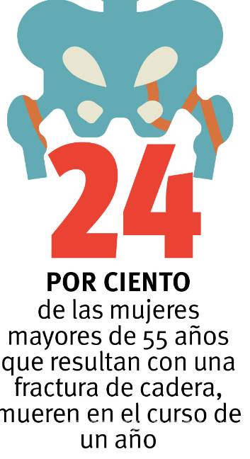 $!Osteopenia y osteoporosis: en busca de huesos fuertes