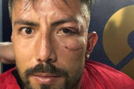 Así fue el brutal golpe que recibió el portero de los Pumas en Copa MX