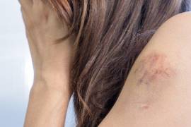 De acuerdo a los reportes de salud, se atiende una mujer diario derivado de violencia en su contra.