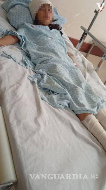 Niña es brutalmente atacada por un perro en Frontera (video)