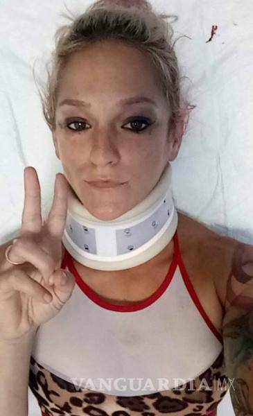 $!Chica acróbata se rompe el cuello tras brutal caída, sobrevivió (video)