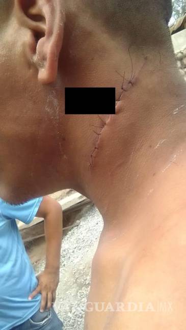 $!Edgar recibió atención médica urgente debido a una herida en el cuello que afectó una vena.