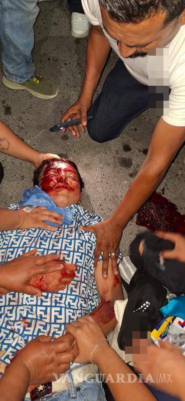 $!El motociclista quedó tendido sobre el pavimento tras el impacto, sin portar casco.