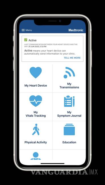 $!Menú en inglés de 'app' móvil para trasmitir datos de monitorización cardíaca. EFE/Medtronic