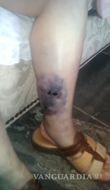 Denuncian por maltrato y lesiones a asilo de adultos mayores de Saltillo