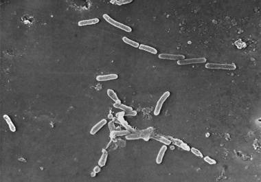 Esta imagen de microscopio electrónico proporcionada por los Centros para el Control y la Prevención de Enfermedades de EU muestra la bacteria Pseudomonas aeruginosa. AP/Janice Haney Carr/CDC