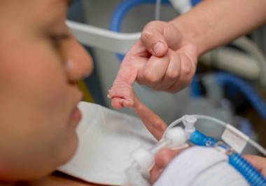 Saltillo y Torreón concentran buena parte de los casos, con alta proporción de bebés nacidos entre las 28 y 36 semanas.