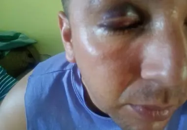 Erick Daniel presenta hematomas considerables en el área del rostro tras las agresiones sufridas al interior del centro de rehabilitación.
