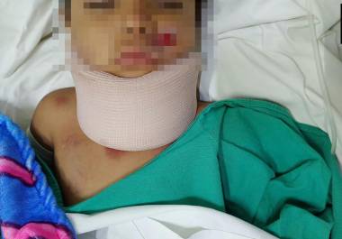 Familiares del menor solicitaron apoyo para localizar al conductor involucrado en el percance.