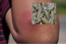 Refuerzan acciones de educación sanitaria en comunidades, principalmente para promover la detección temprana de posibles casos.