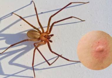 Especialistas recomendaron reforzar medidas de prevención en los hogares, como fumigaciones periódicas y revisión de espacios cerrados.