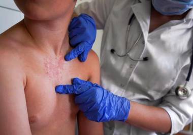 La Secretaría de Salud implementó cercos sanitarios en el entorno de los planteles y en los domicilios de los alumnos que enfermaron.